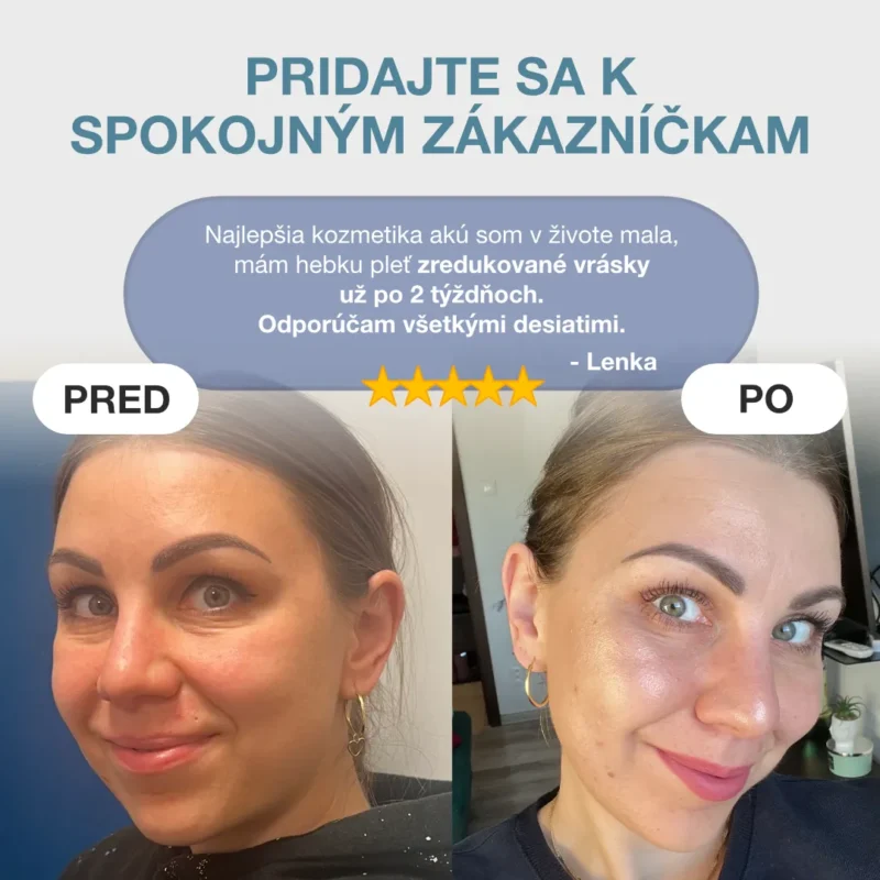 elixír mladosti skúsenosti